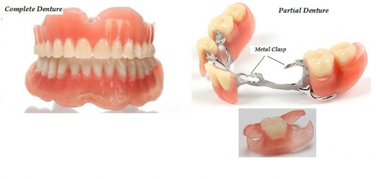 dentures-540x258.png